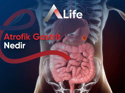 Atrofik Gastrit Nedir?